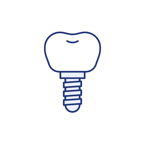インプラント
